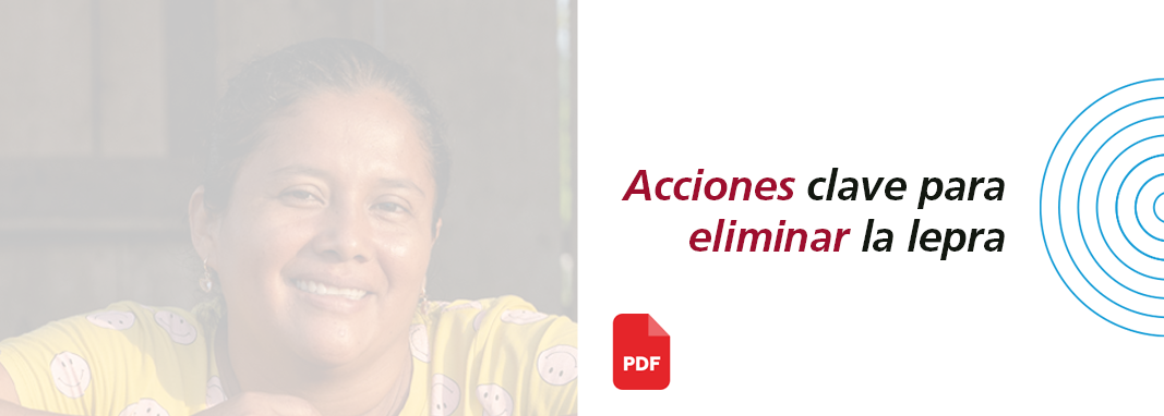 Claves para eliminar la lepra